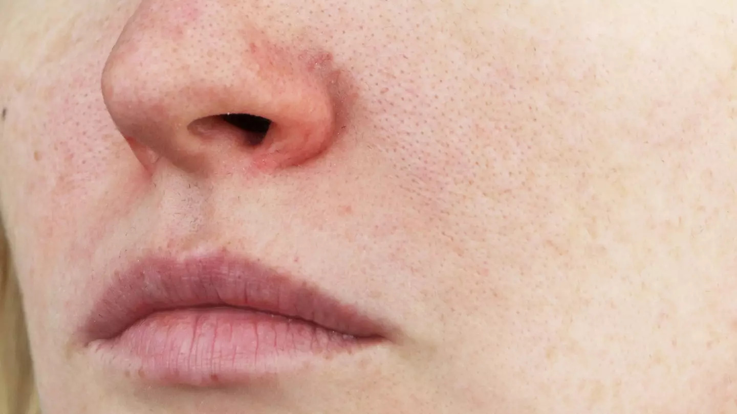 'Autumn face' explained as doctor issues advice for anyone affected