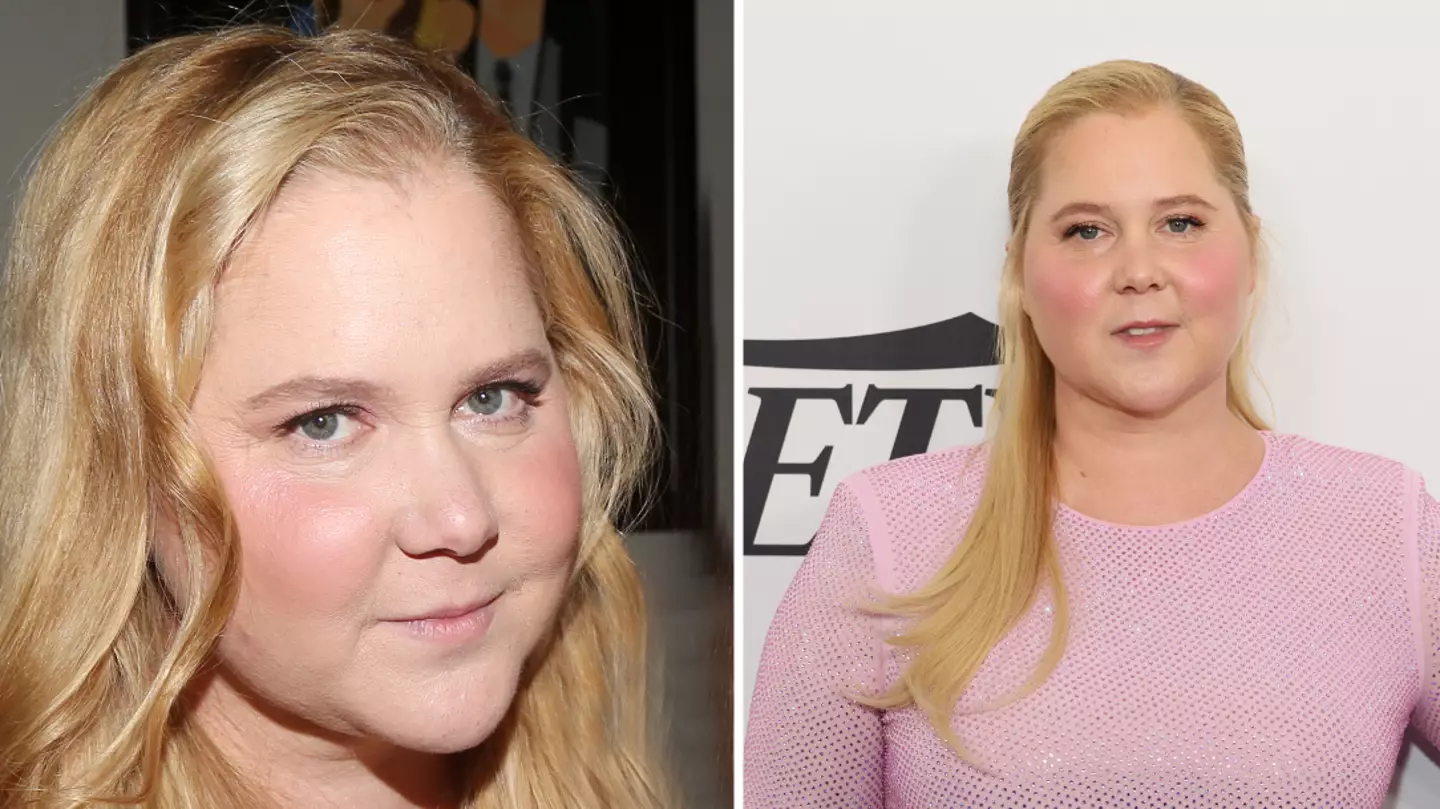 Amy Schumer had perfect response to concern about her ‘puffier face’ as she revealed reason behind it