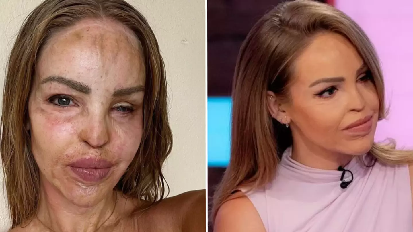 Katie Piper issued support by co-stars after sharing vile message from trolls