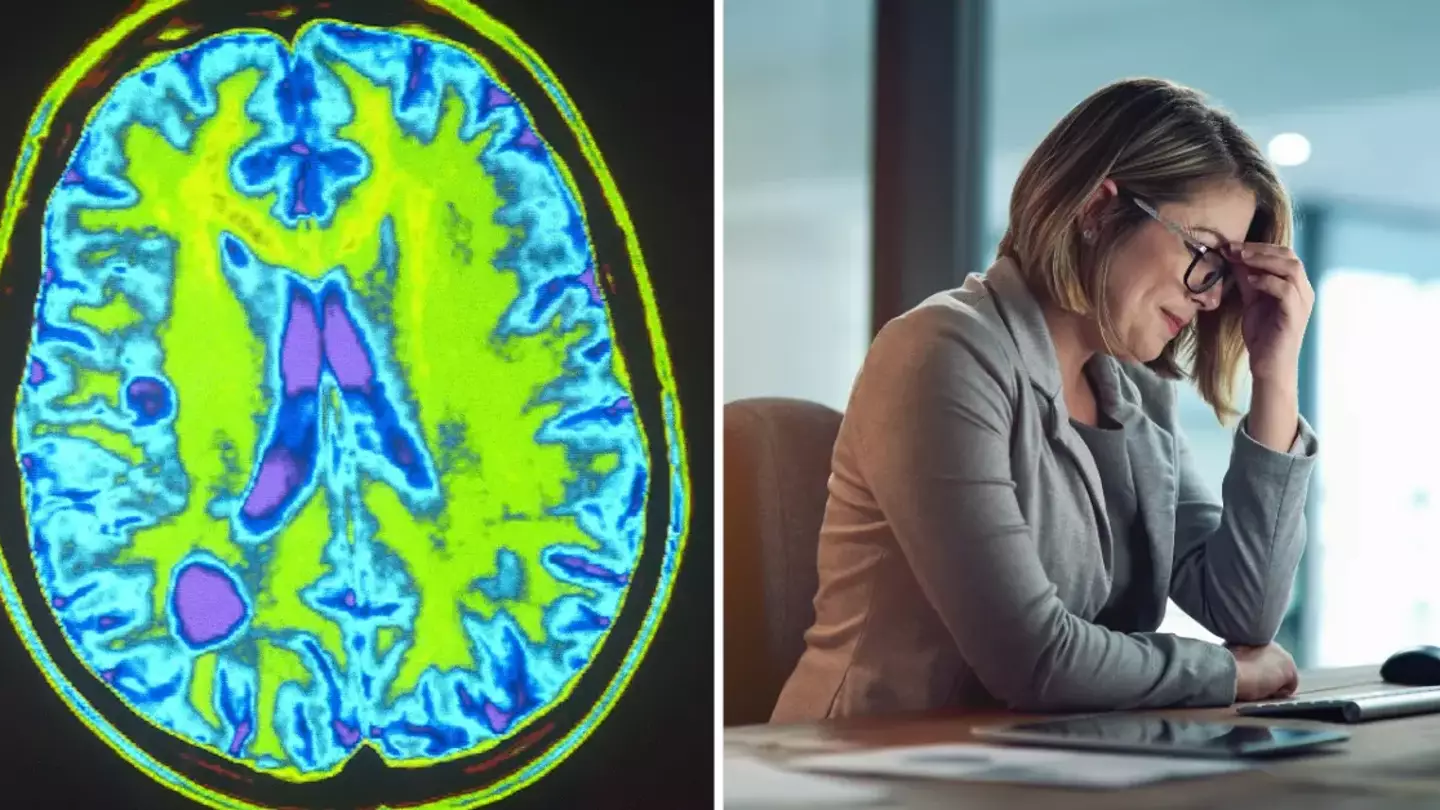 BSIP/Universal Images Group via Getty Images/Getty Stock Image