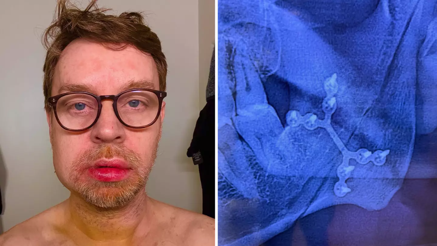 Singer Darren Hayes reveals he ‘nearly died’ in horrifying freak accident