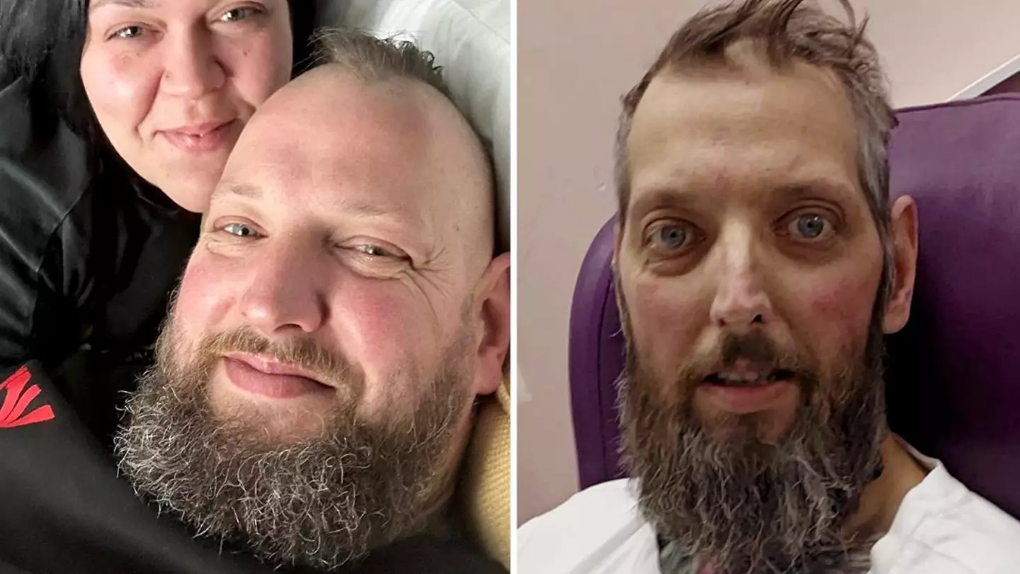 Man given weeks to live after initially thinking he was constipated