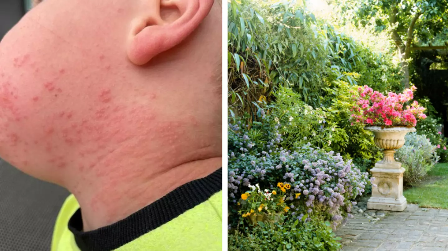 Mum’s Warning After Garden ‘Friend’ Leaves Four-Year-Old In Agony