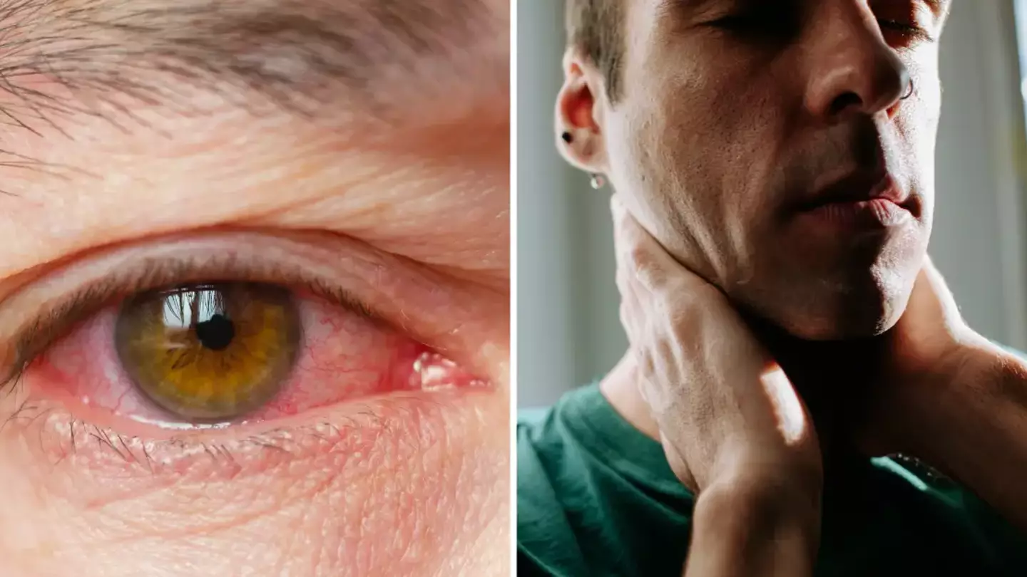 Travel warning issued over rare ‘bleeding eye’ virus