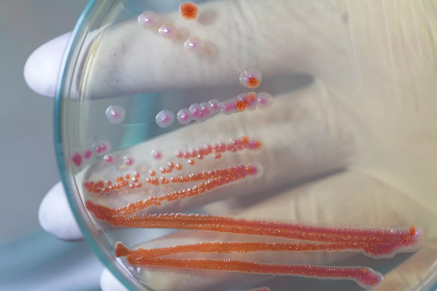 The unnerving pink slime is actually a bacteria called Serratia marcescens (Sinhyu/Getty Images)