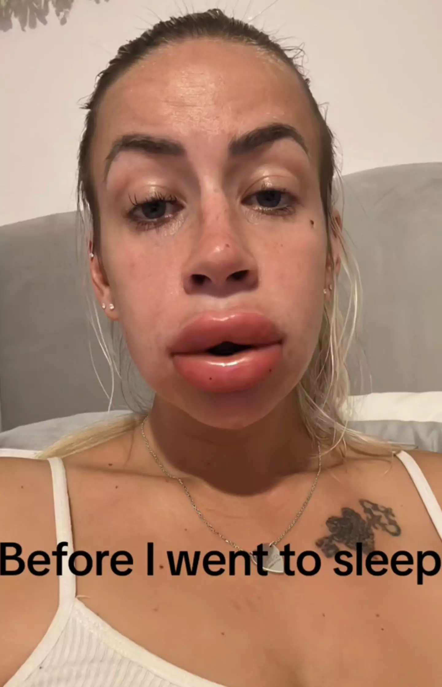 Courtney's lips continued to swell.