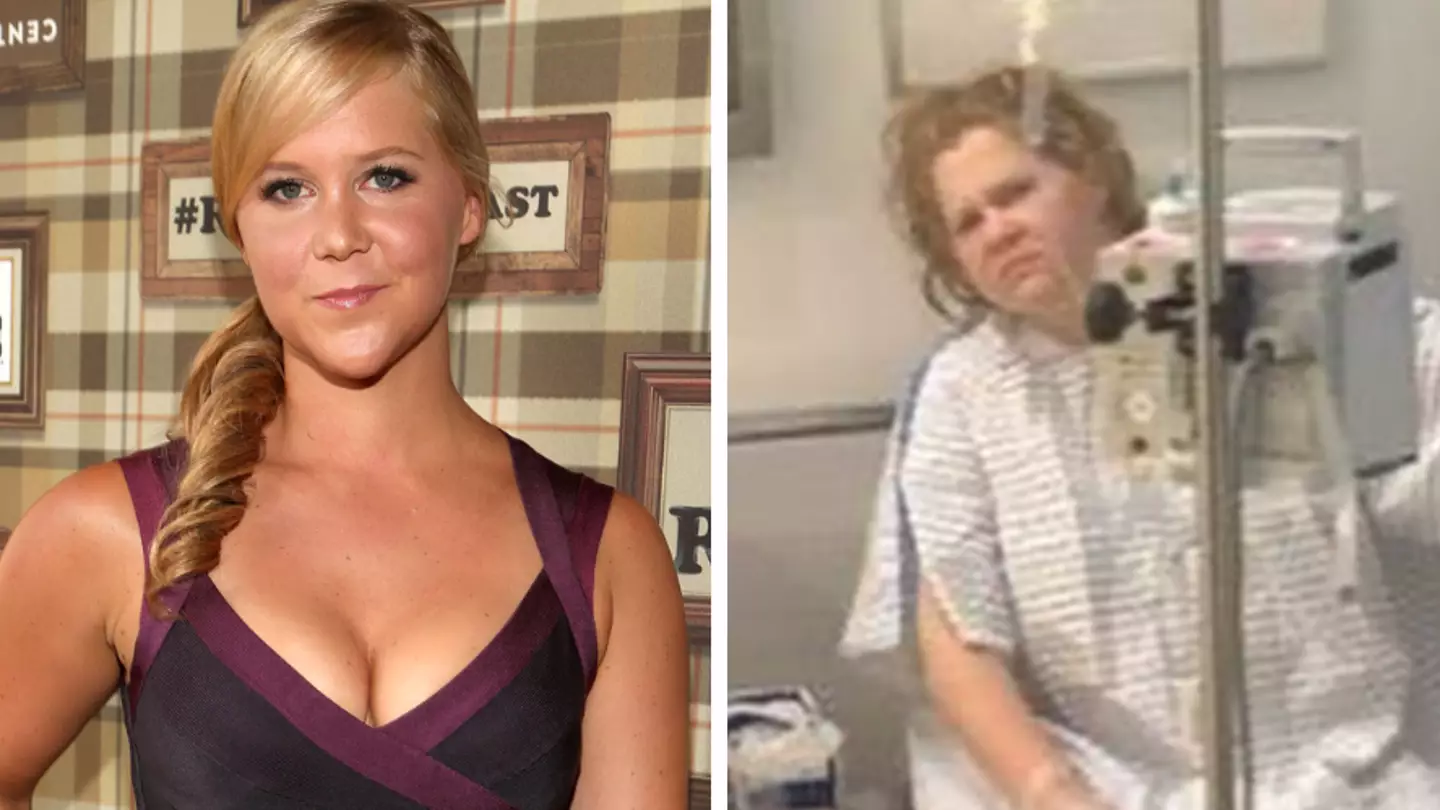 Amy Schumer issues warning to everyone in their 20s with before-and-after photos