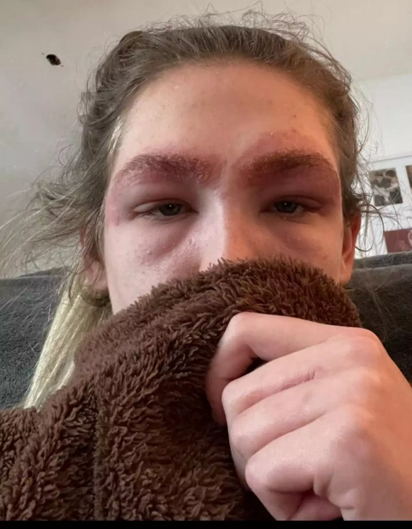 A woman was left hospitalised after suffering from an allergic reaction while getting her eyebrows tinted.