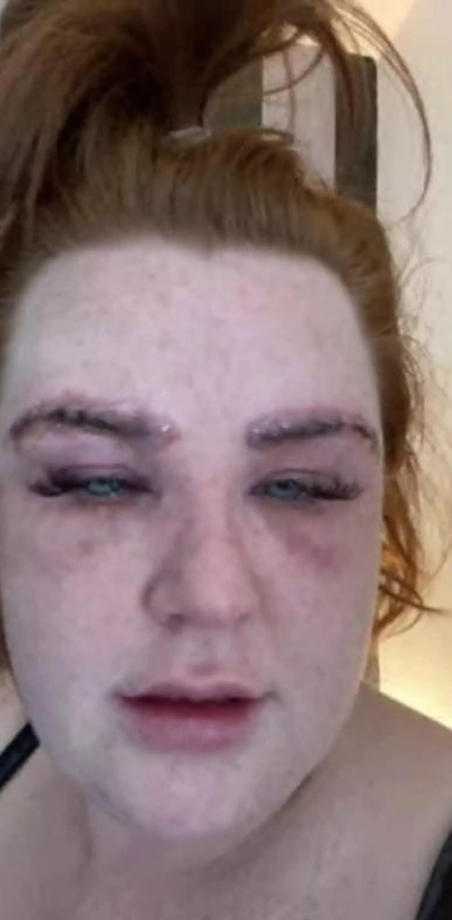 Michelle was rushed to A&E.