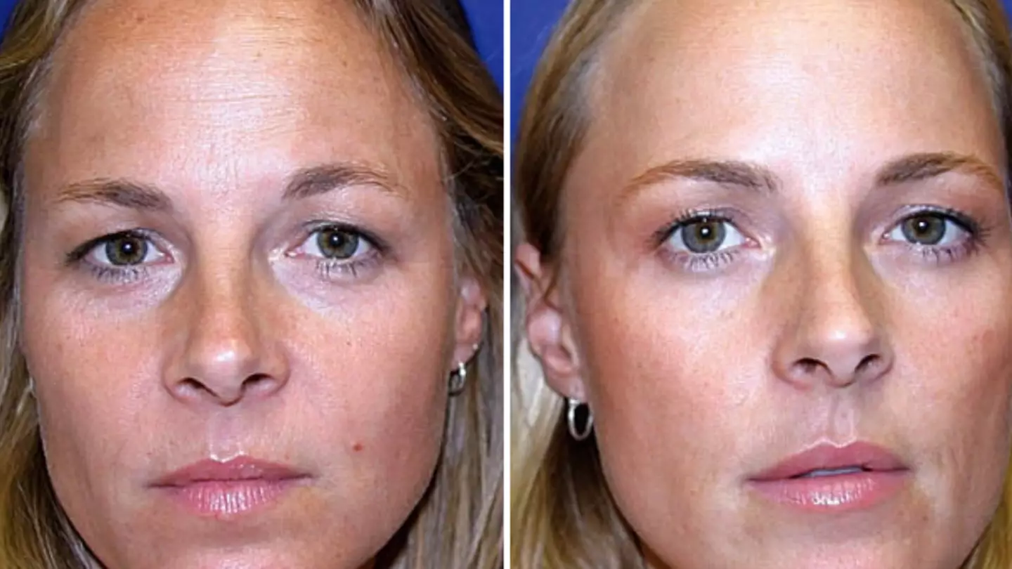 American Society for Dermatologic Surgery
