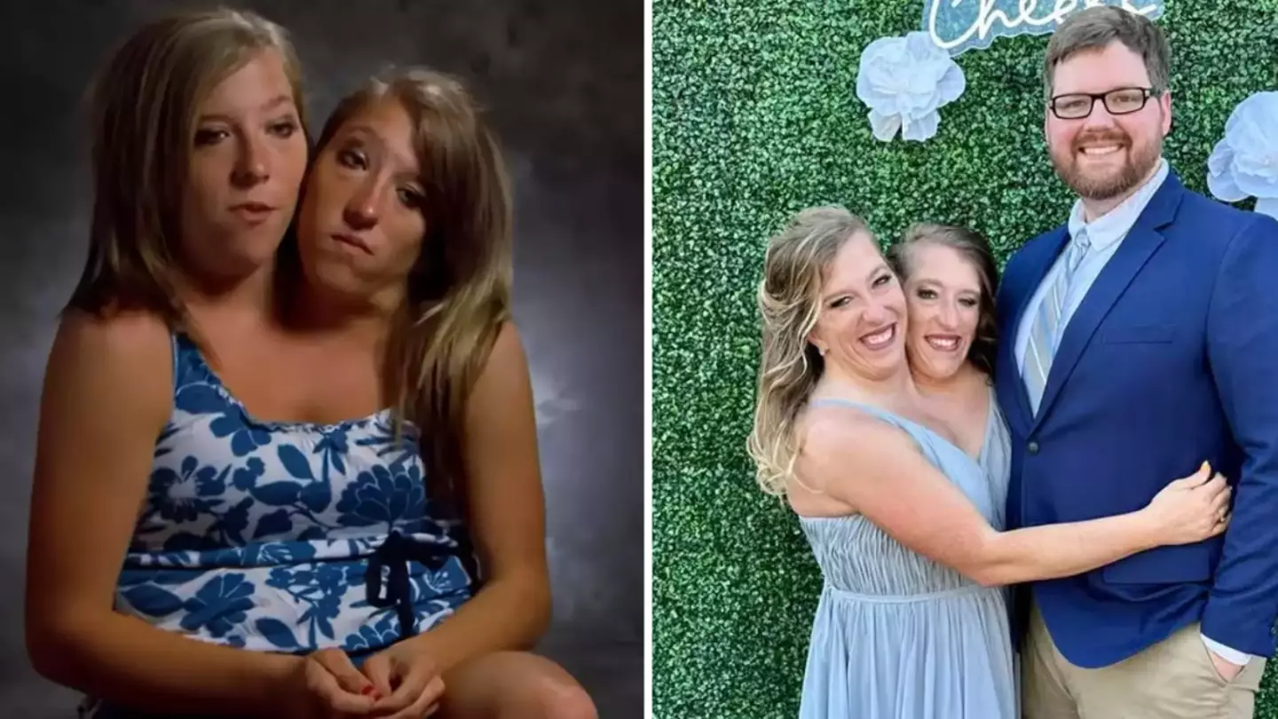 TikTok/@abbyandbrittanyhensel