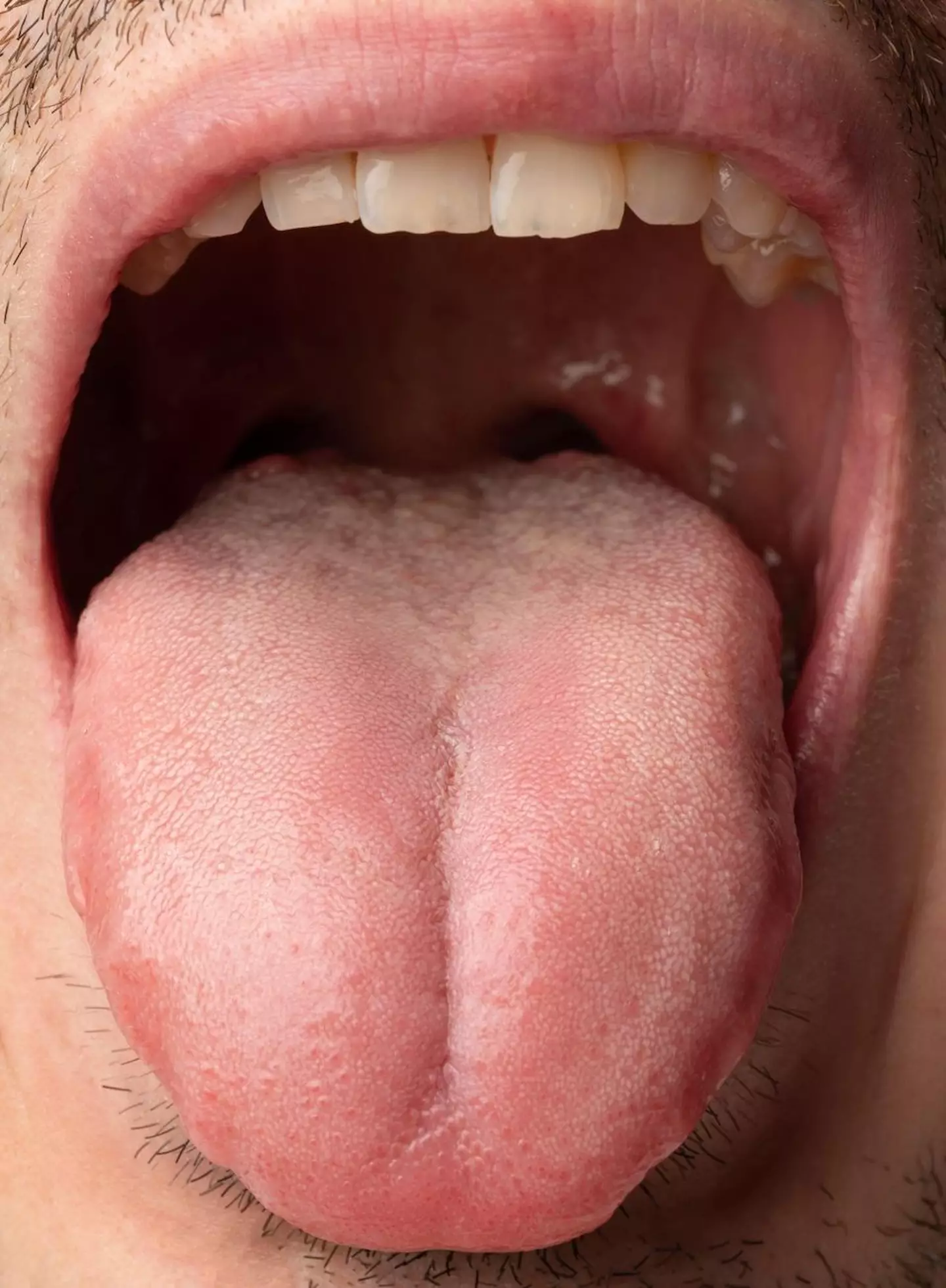 A woman in France - who claims she was sexually assaulted - bit off a man's tongue and handed it in to police as evidence.