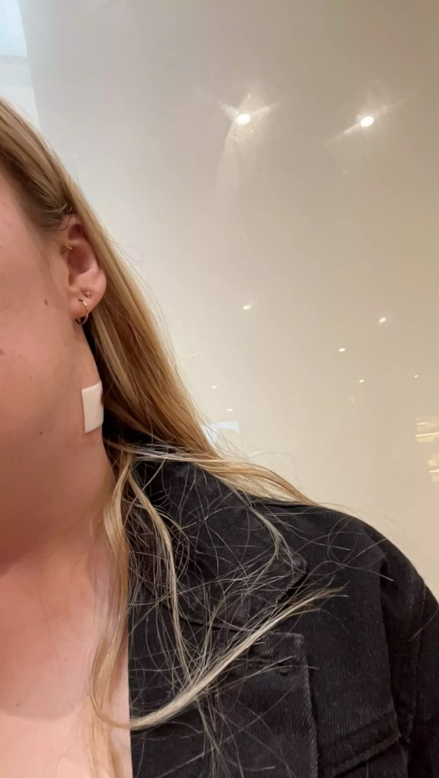 Jasmine pushed doctors to do a biopsy of the lump on her neck, which later confirmed it was cancer. (Kennedy News Media)