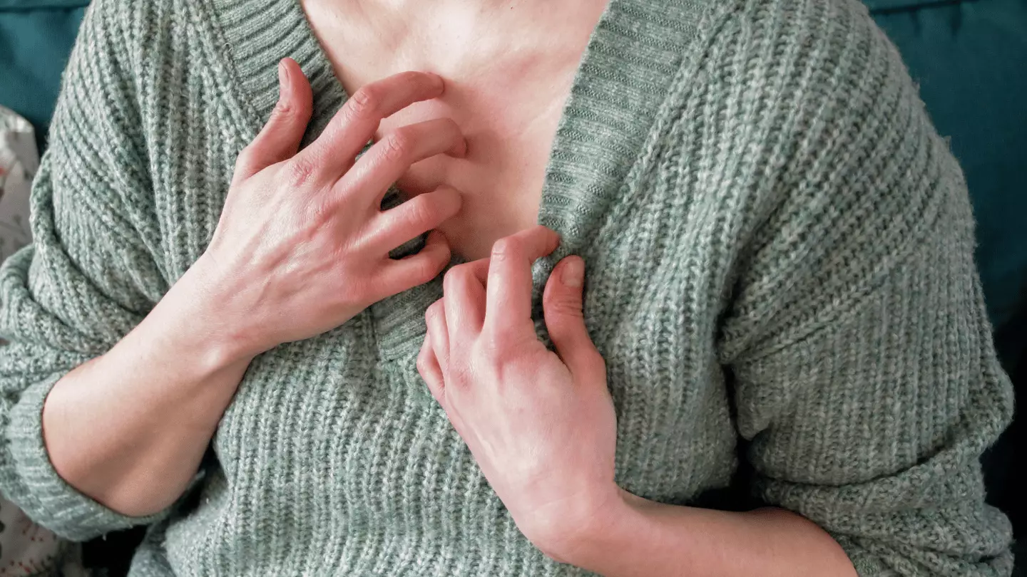 Scabies survivors detail 'nightmare' post-scabies syndrome - watch out for these signs