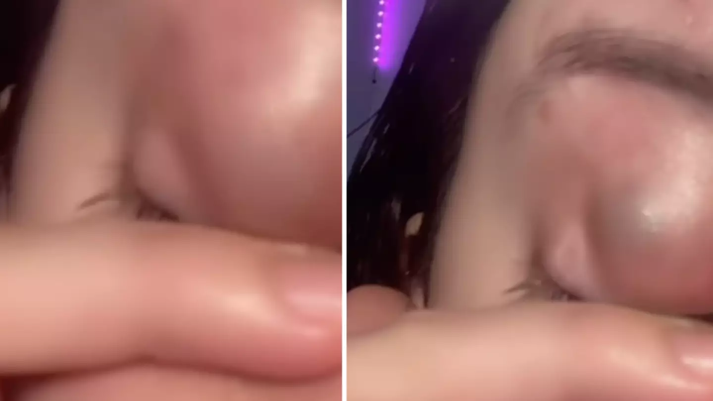 People disturbed after realising their eyelids ‘are transparent’