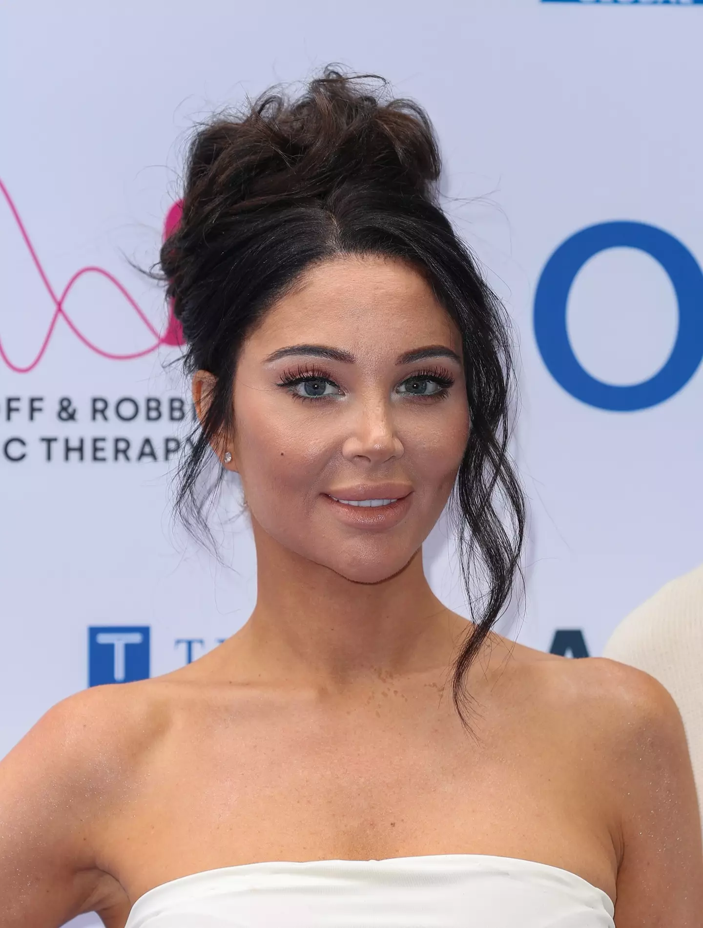 The singer's appearance changed following a heartbreaking health diagnosis (Mike Marsland/WireImage)