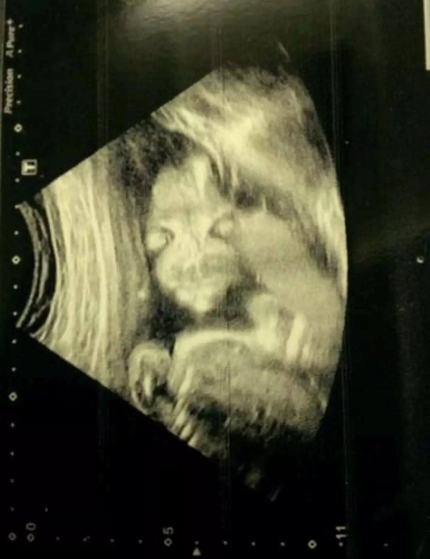The expectant mother was shocked to see her baby's "demonic" appearance (