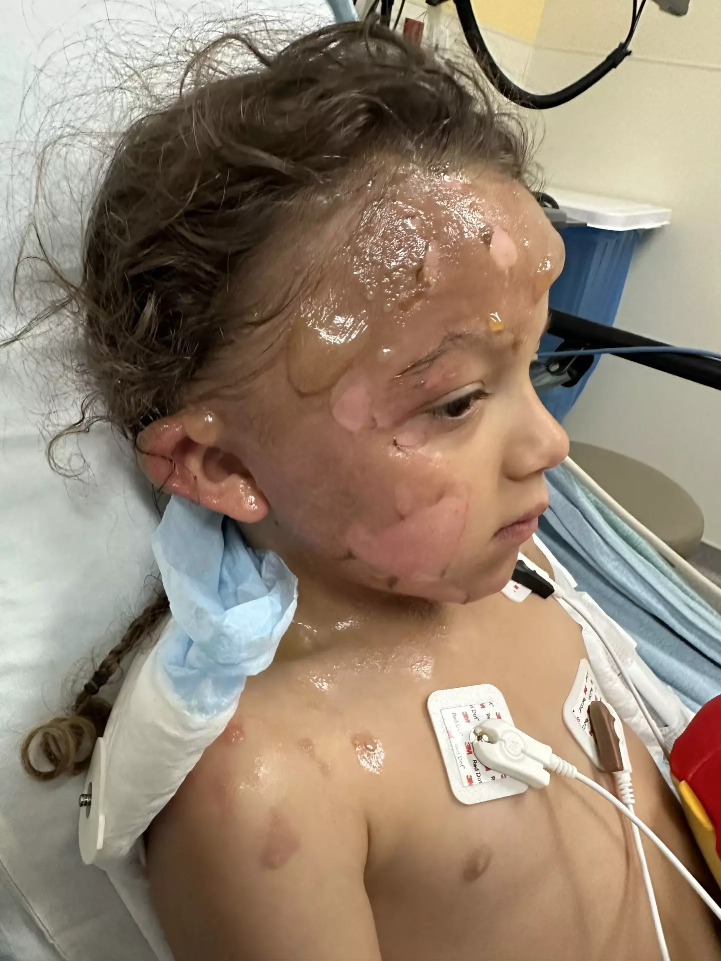 The toddler was left in excruciating pain. (Kennedy)