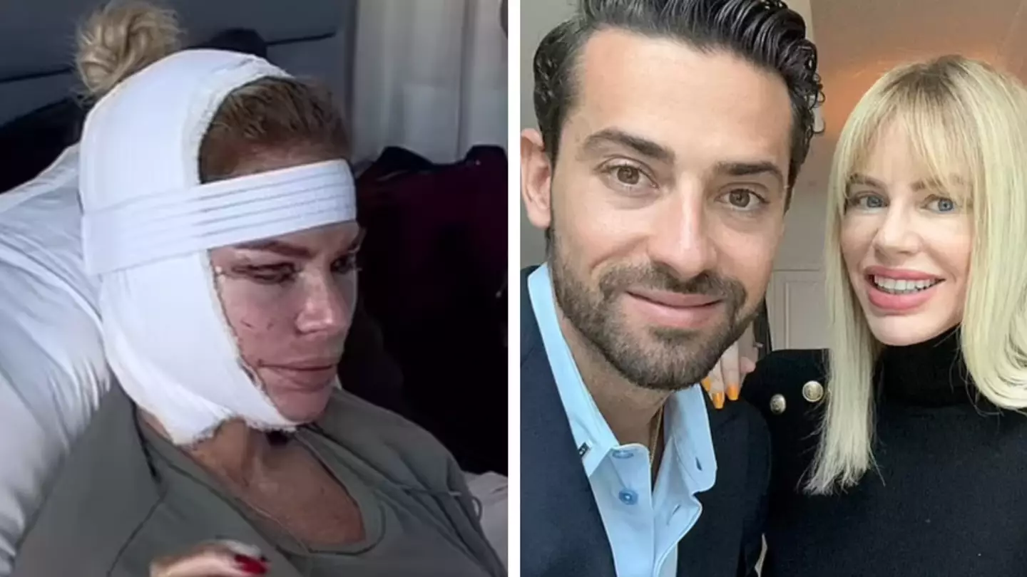 Real Housewives star Caroline Stanbury shows off results of 'petrifying' botched facelift