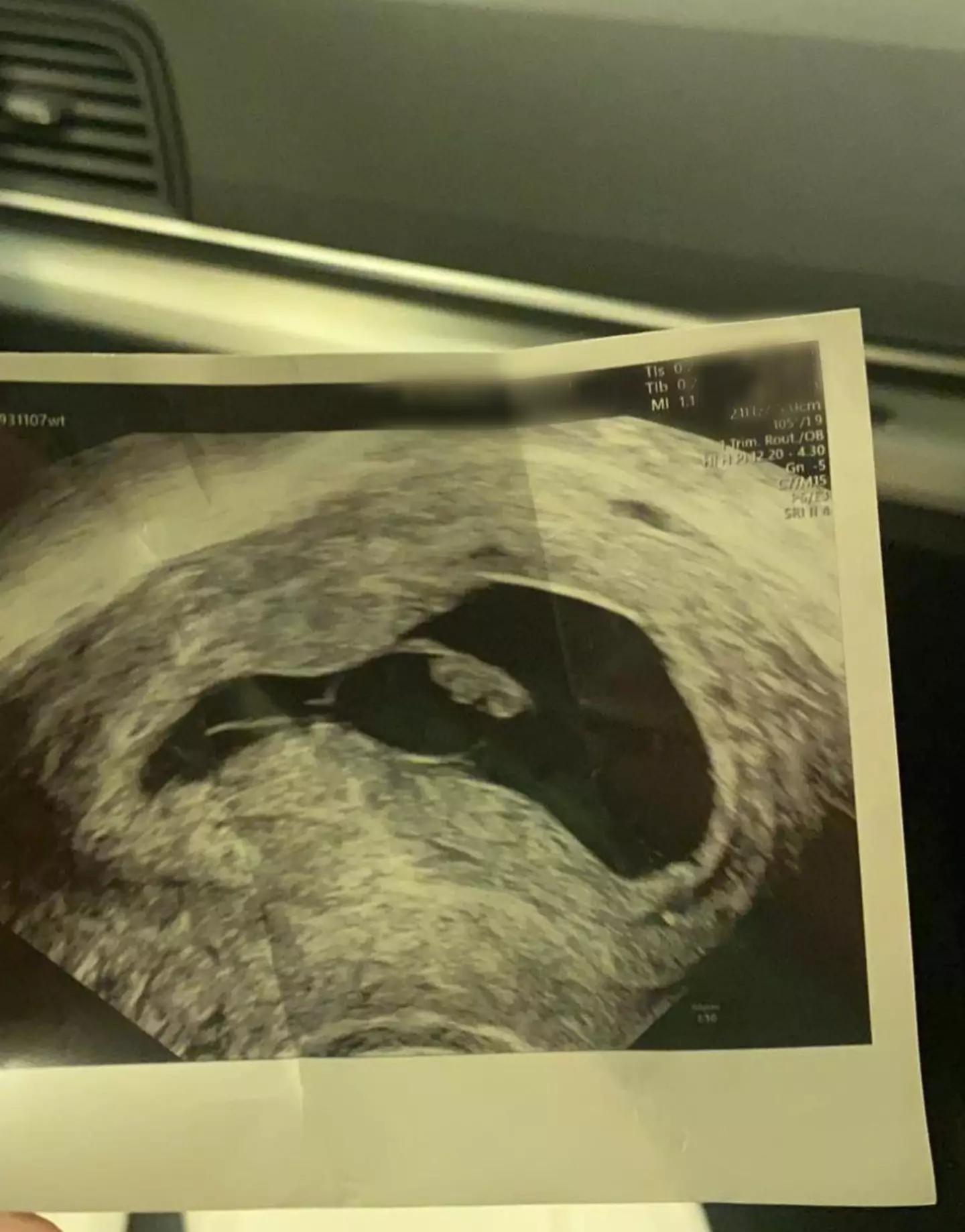 Tiffany hopes the shed the stigma around talking about miscarriages. (