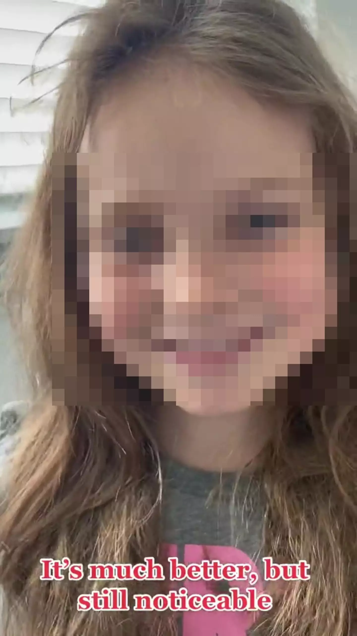 Although her daughter has recovered, the internet has been deeply divided by the decision.