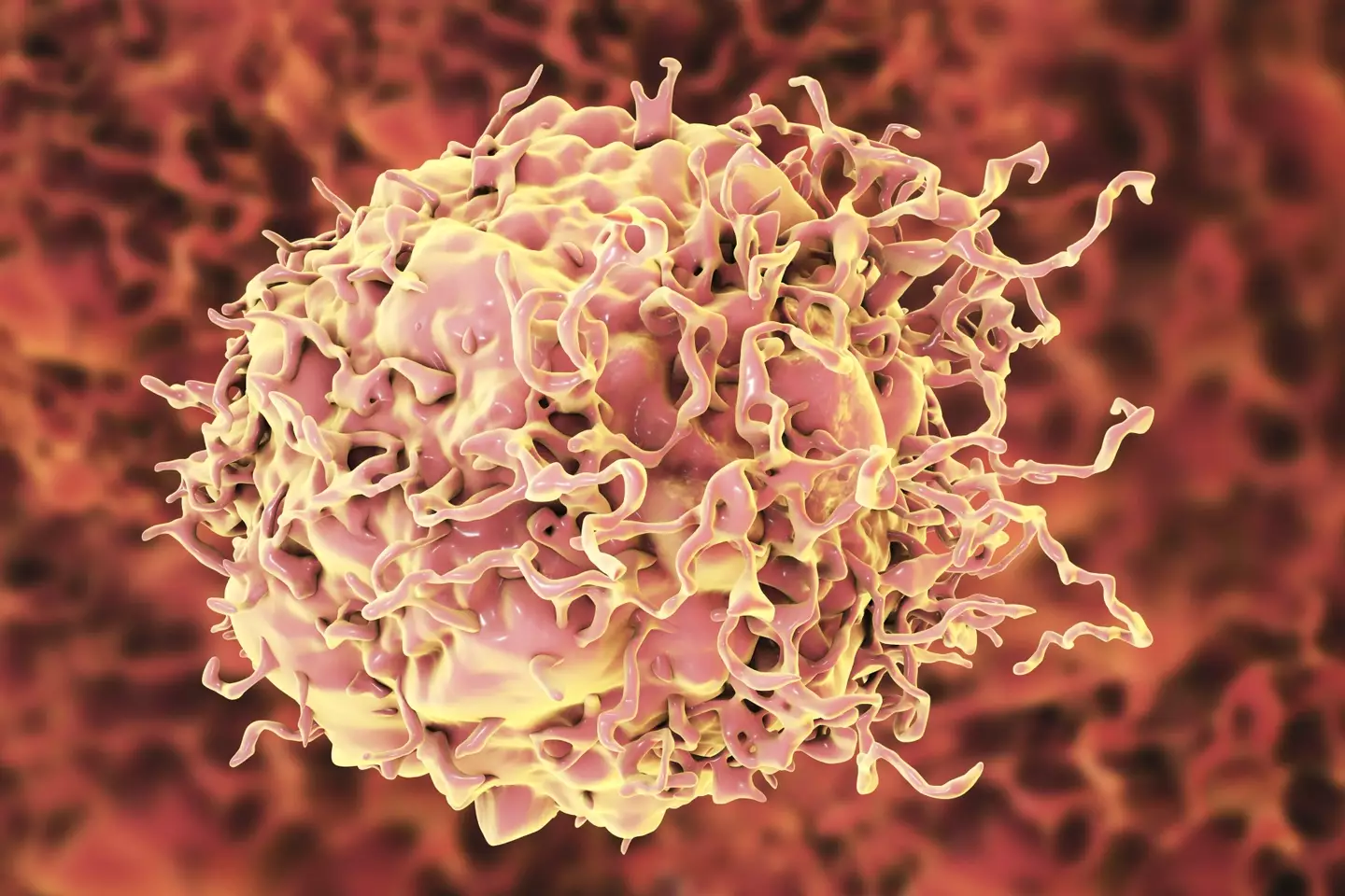 There has been a rise in bowel cancer among young people. (Getty stock images)