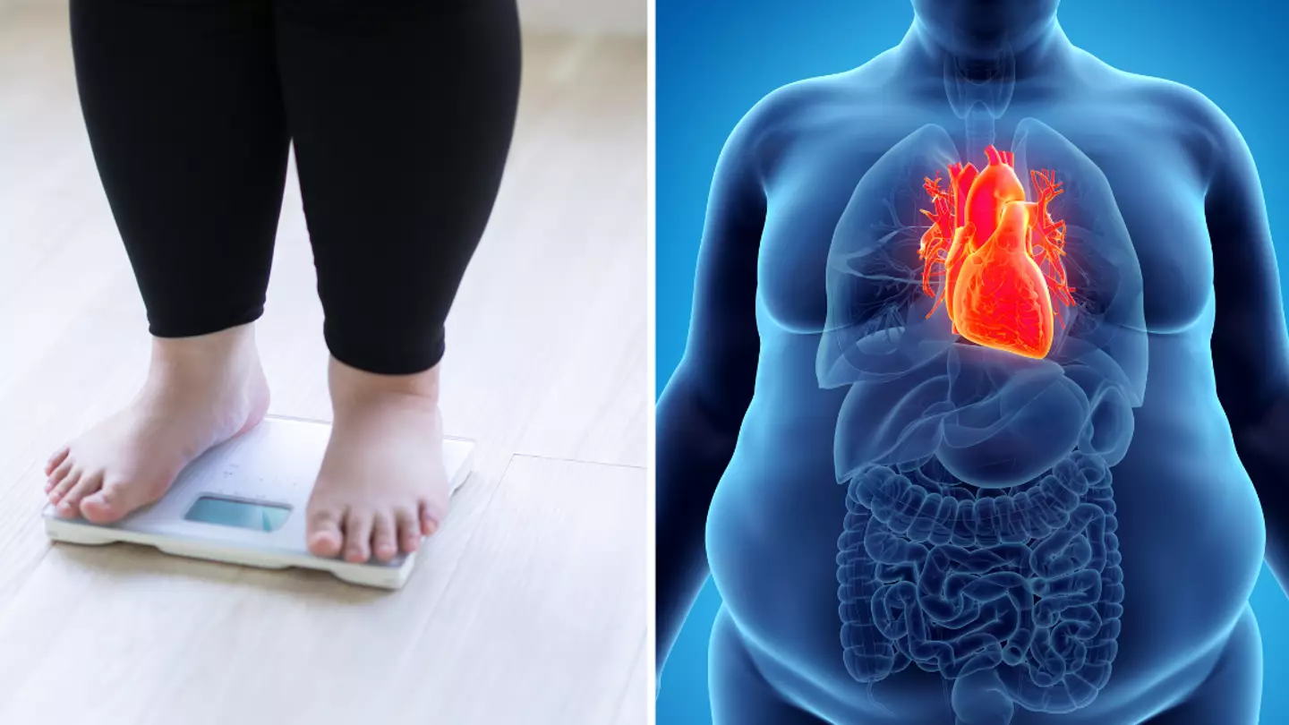 Signs you could be obese regardless of what your BMI is