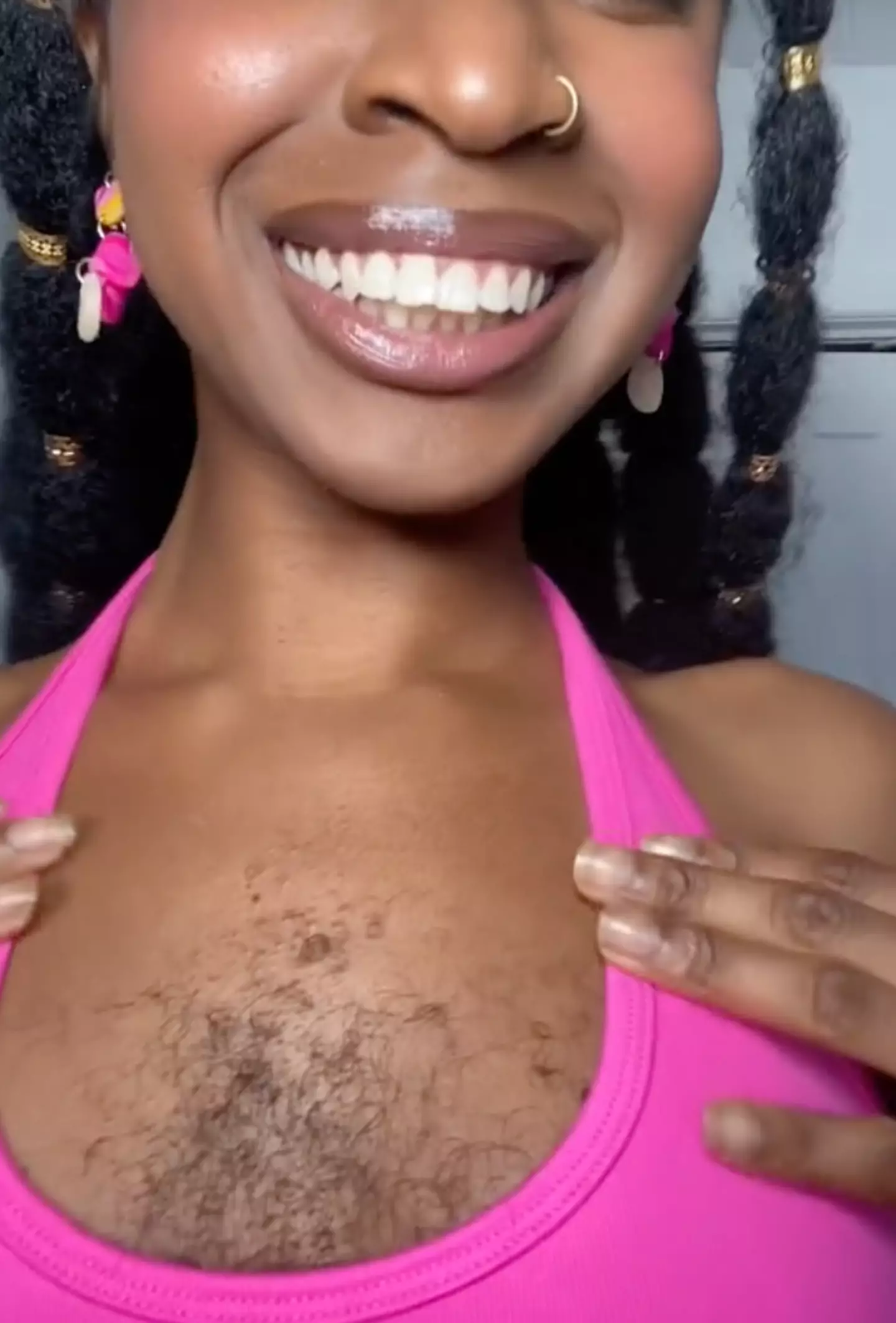 She started growing chest hair when she was 11.