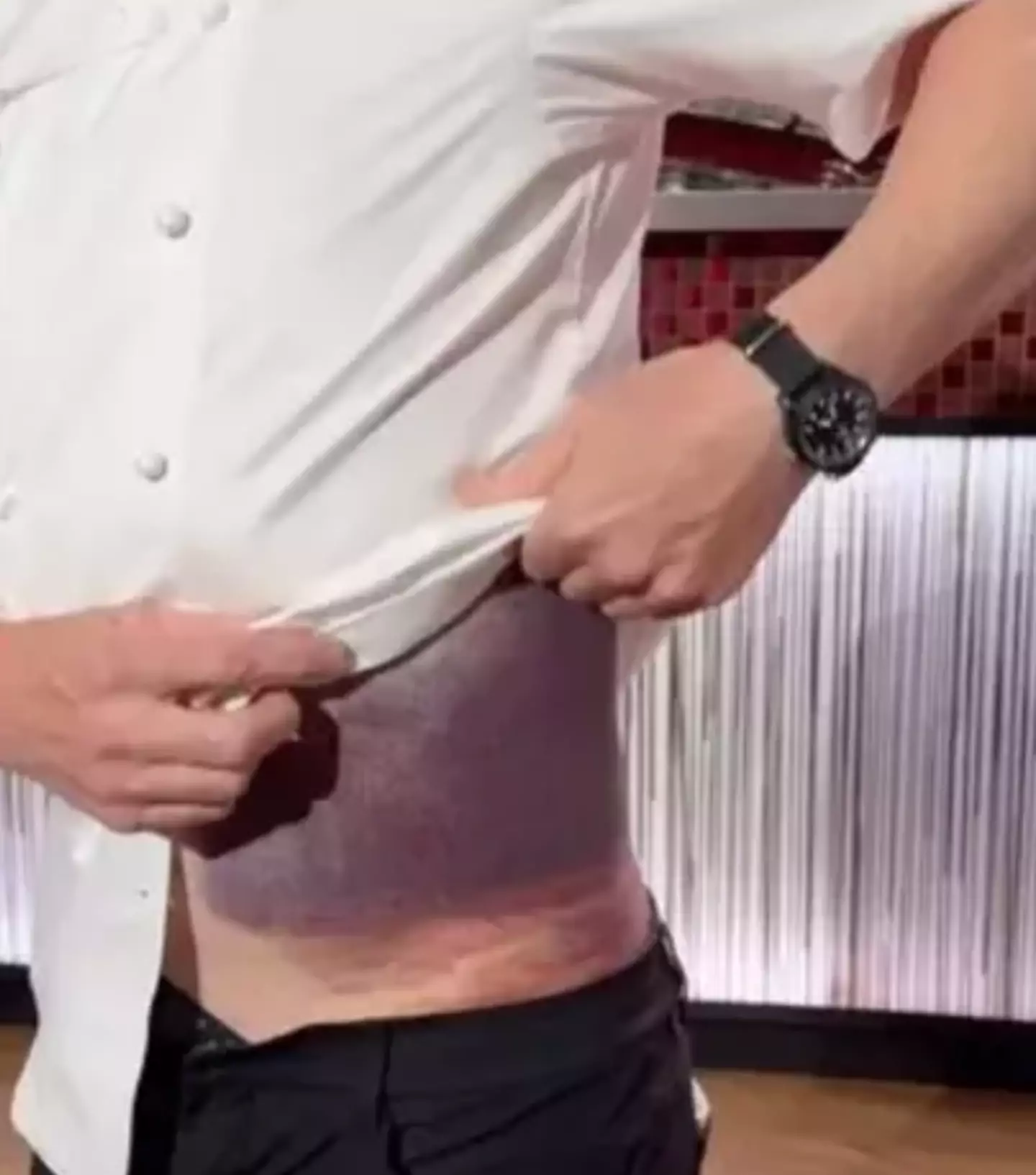 Ramsay was injured in a bike accident last year (Instagram/@gordongram)