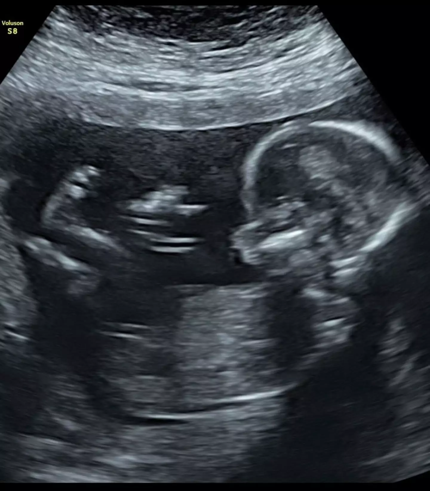The MAFS star shared an ultrasound of her baby boy.