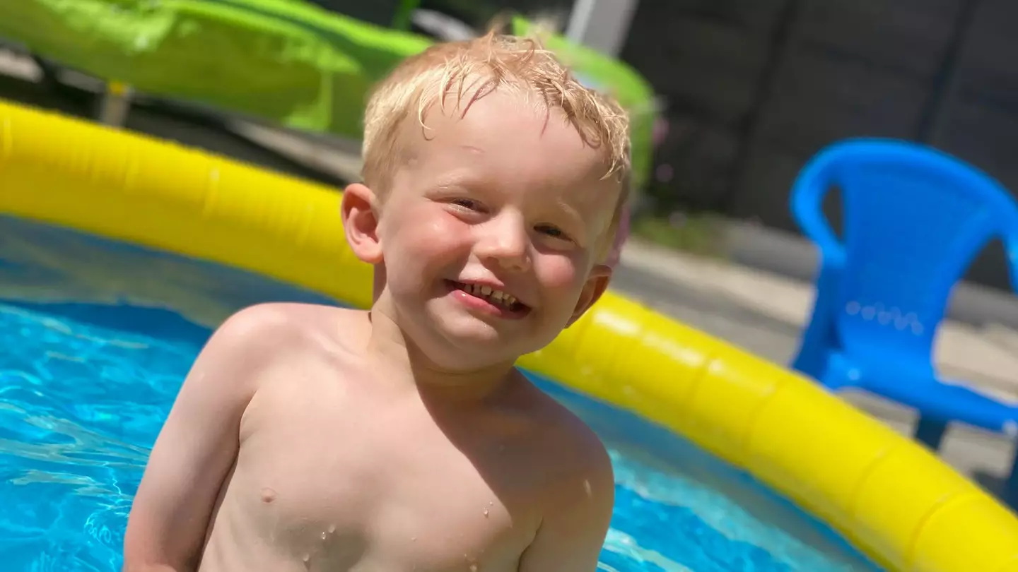 Toddler Left With Blisters Despite Using Aldi SPF 50