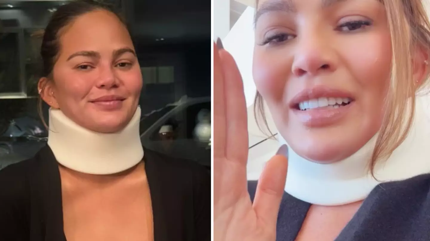 Chrissy Teigen worries fans as she reveals terrifying injury before Met Gala