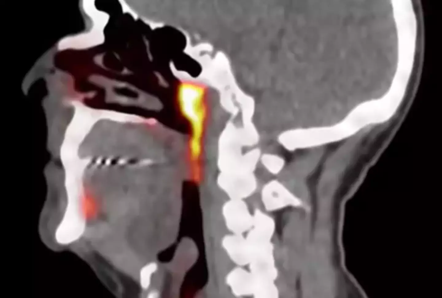 That glowing thing is the organ you've only just heard about (YouTube/Antoni Van Leeuwenhoek)