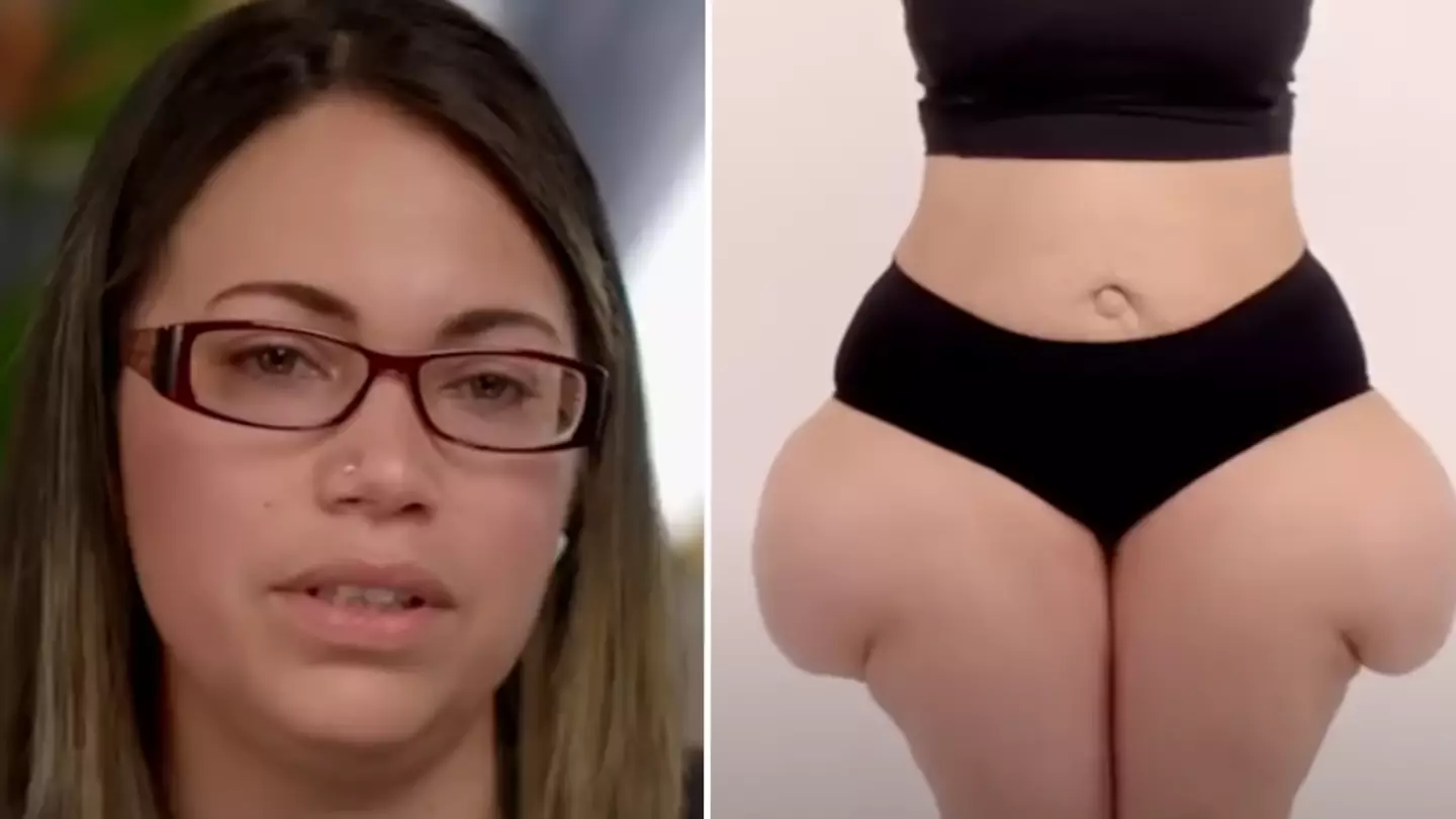 Woman’s hips tripled in size after giving birth to eight kids