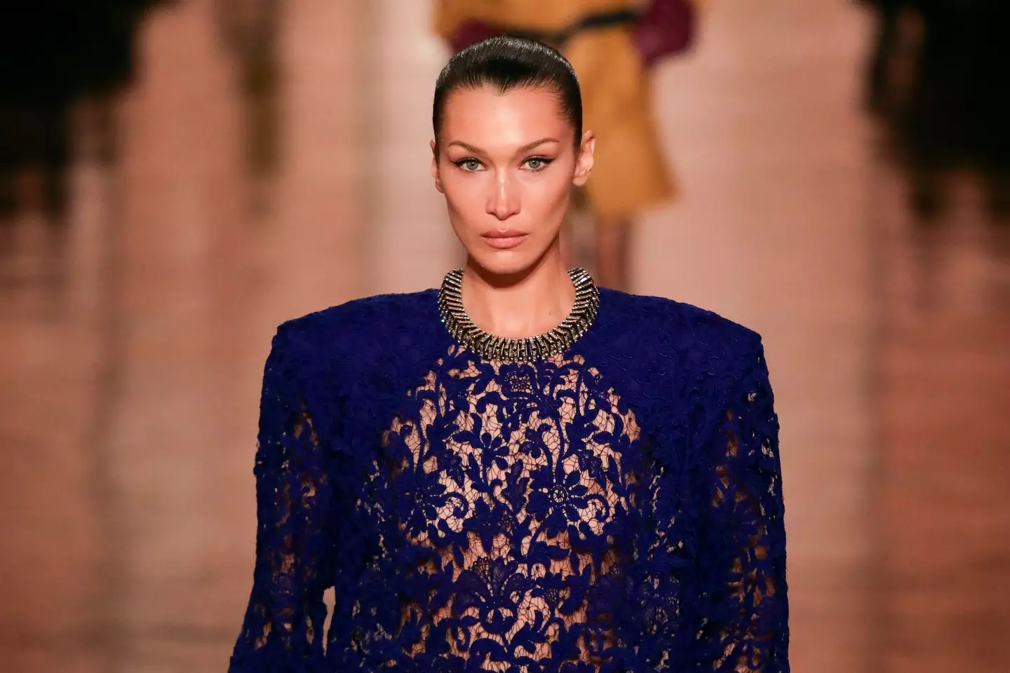 Bella Hadid was diagnosed as a teenager (Antoine Flament/Getty Images)
