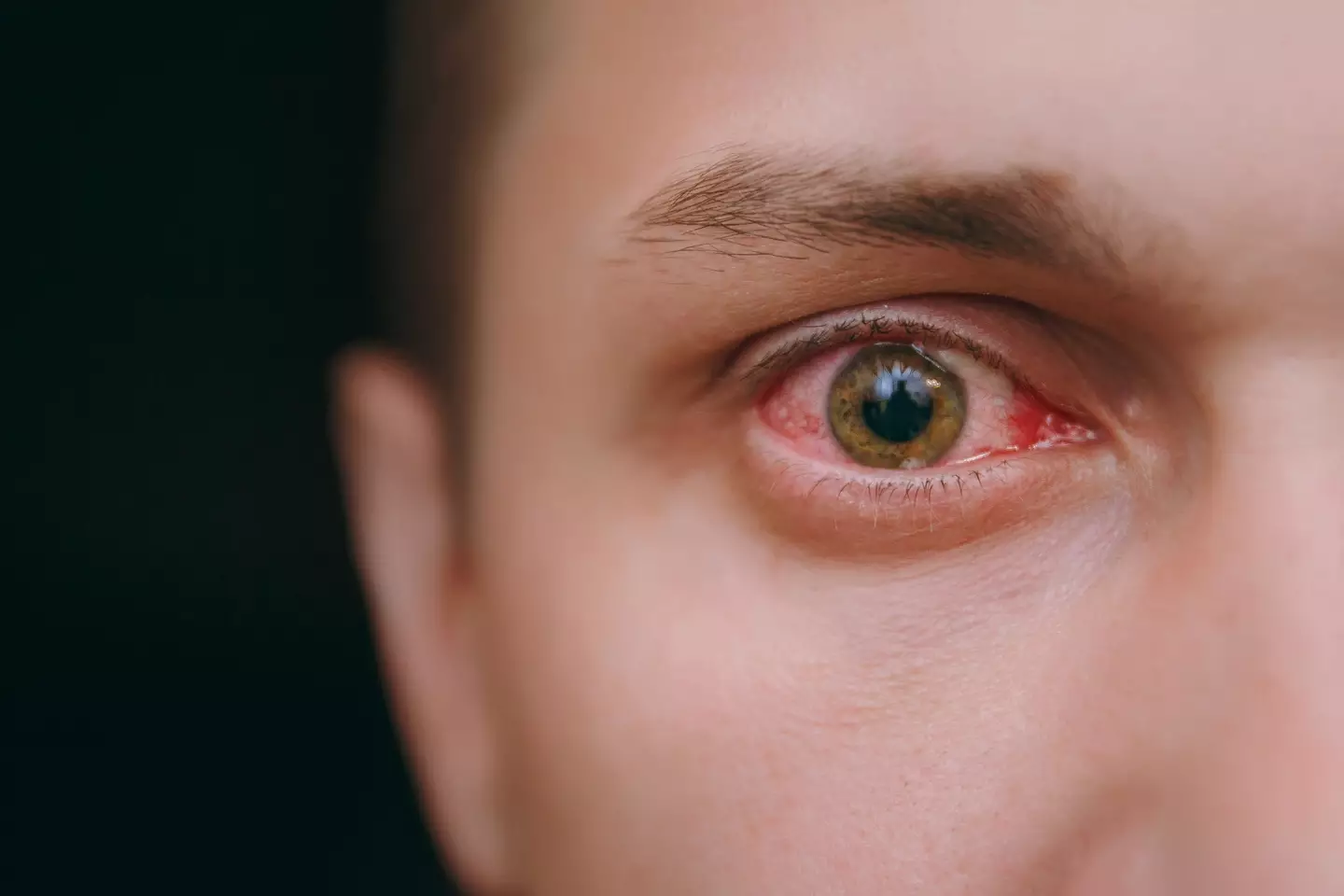 Marburg is a 'severe hemorrhagic fever that can cause serious illness and death (Getty Stock Image)