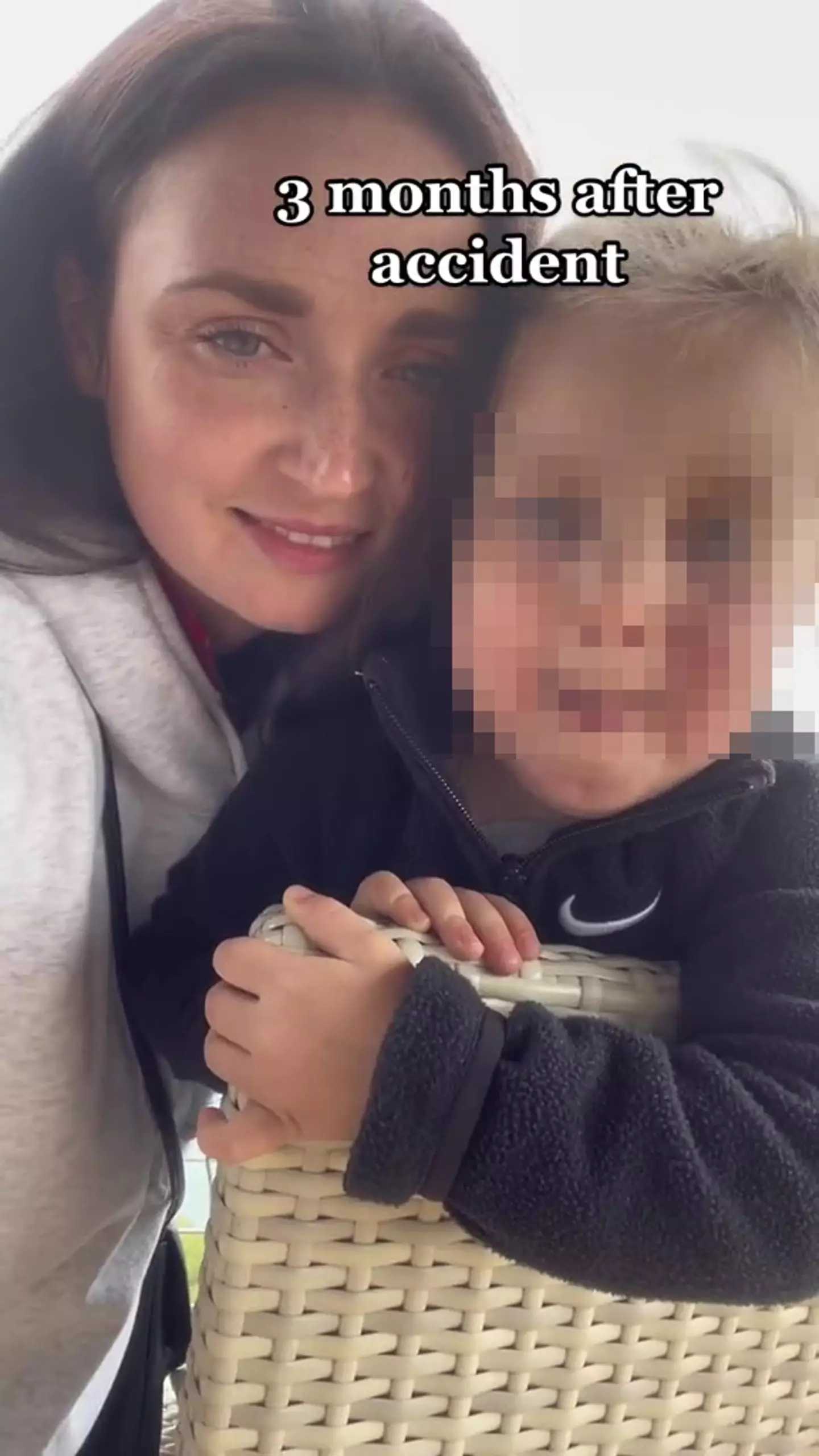 Milana was just three years old when the horrific accident happen.