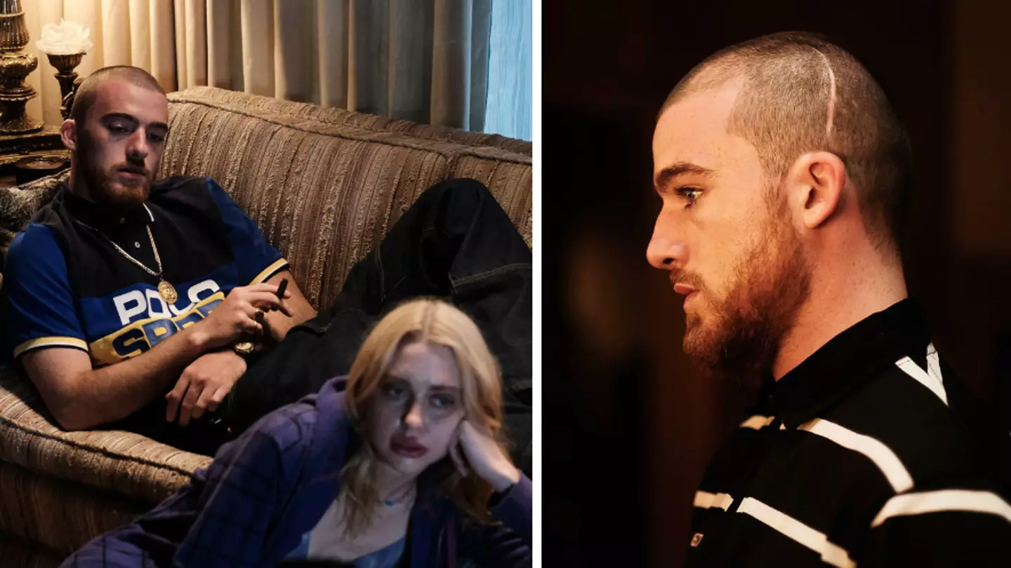 Euphoria star Angus Cloud opens up about how he got his head scar