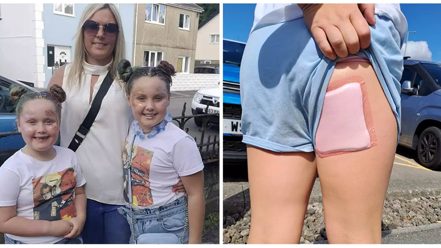 Mum's warning after girl is left with horror burns from 'death slide' at play centre