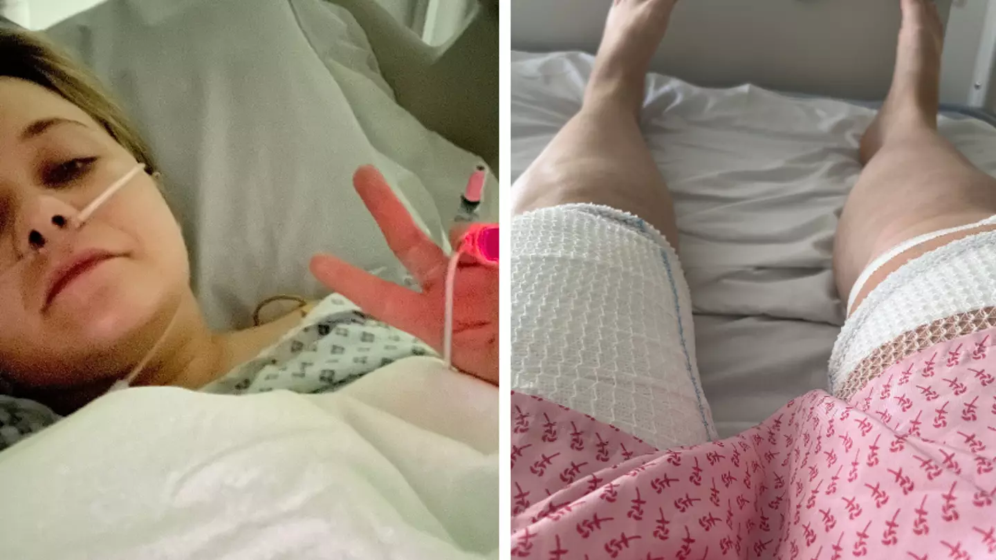 Woman scarred for life from hot water bottle shares secret symbol that shows if yours is out of date