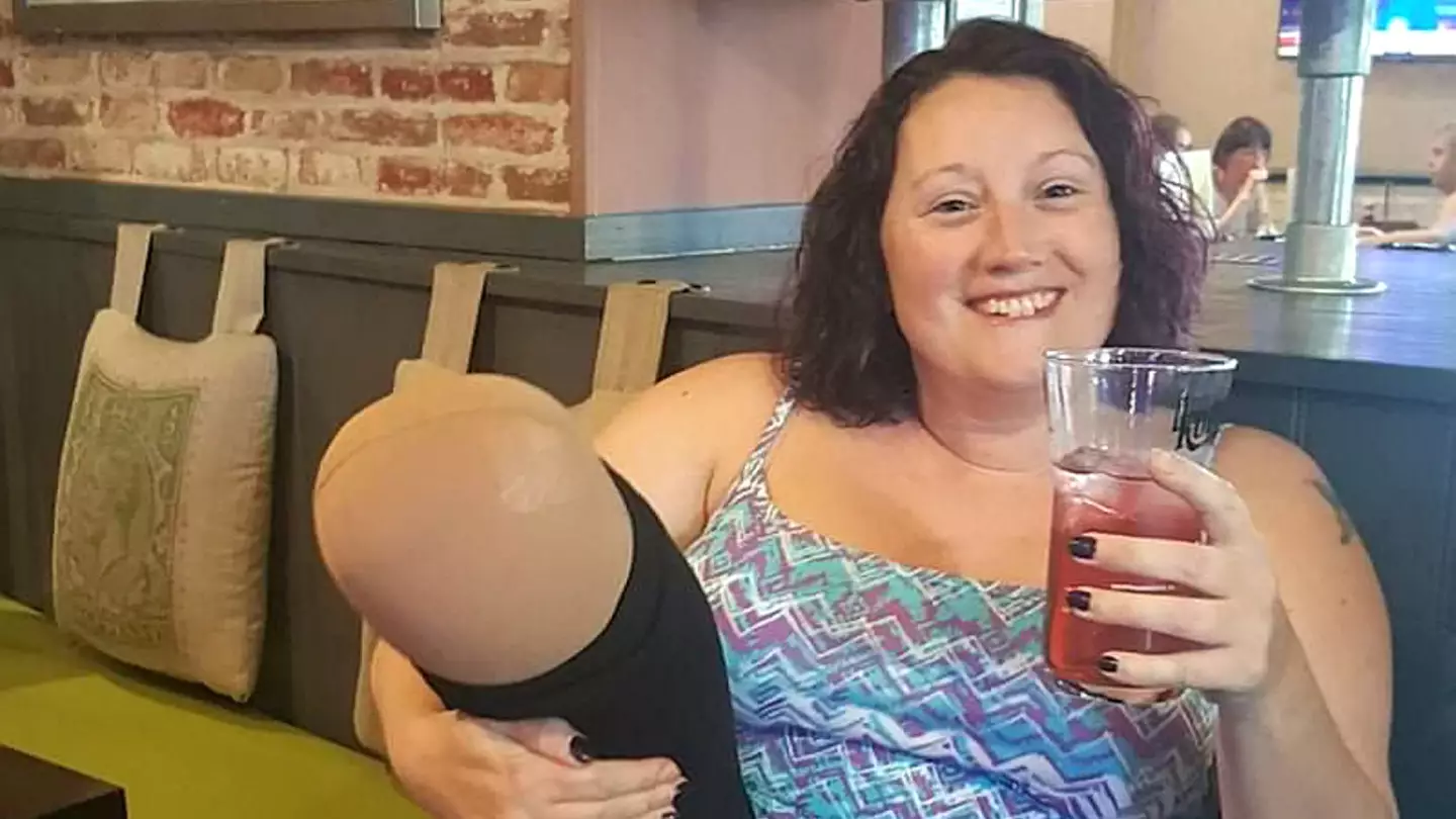 Woman forced to have leg amputated after dropping perfume on her foot