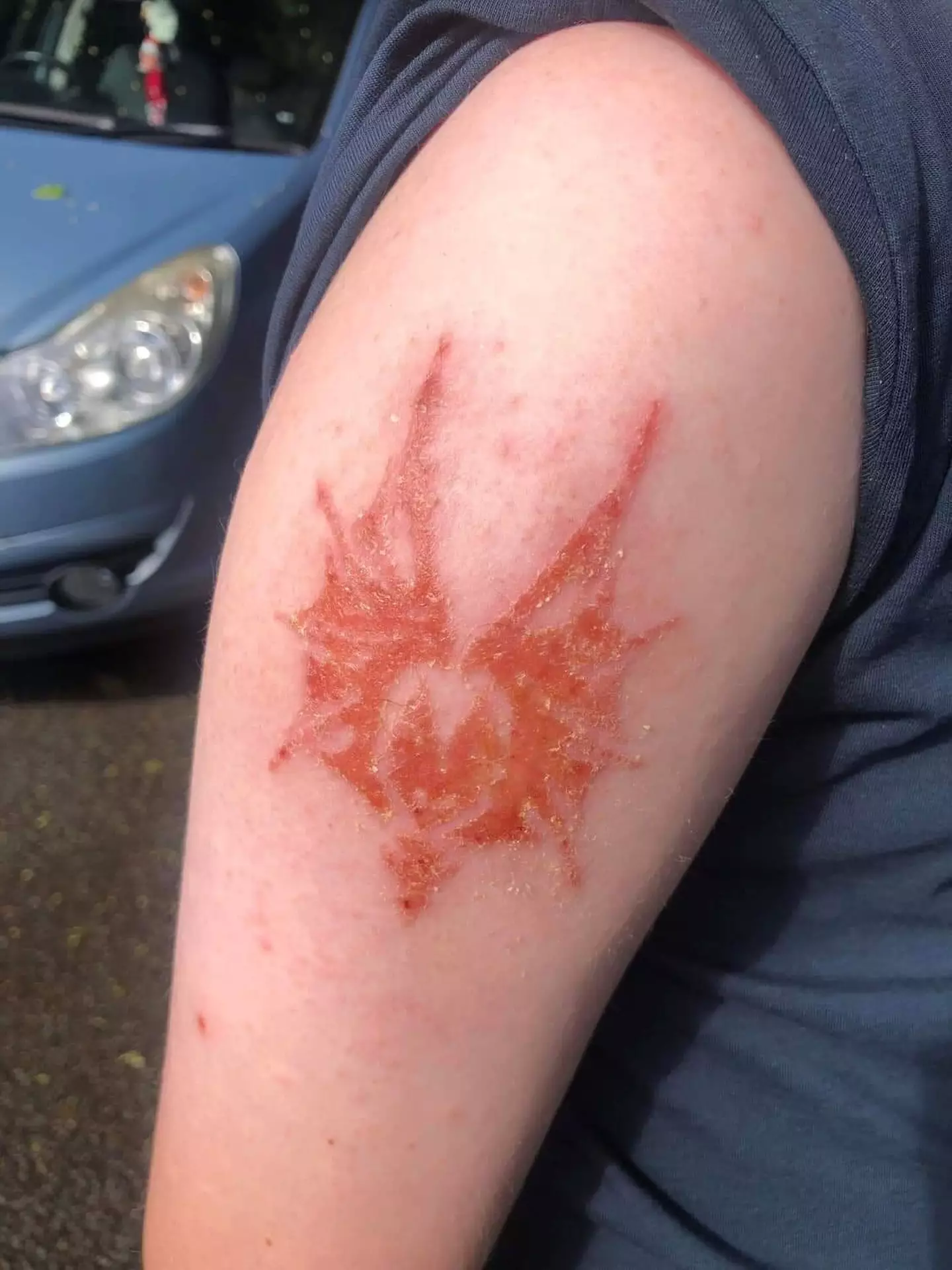 Caden's henna tattoo soon felt 'lumpy'.