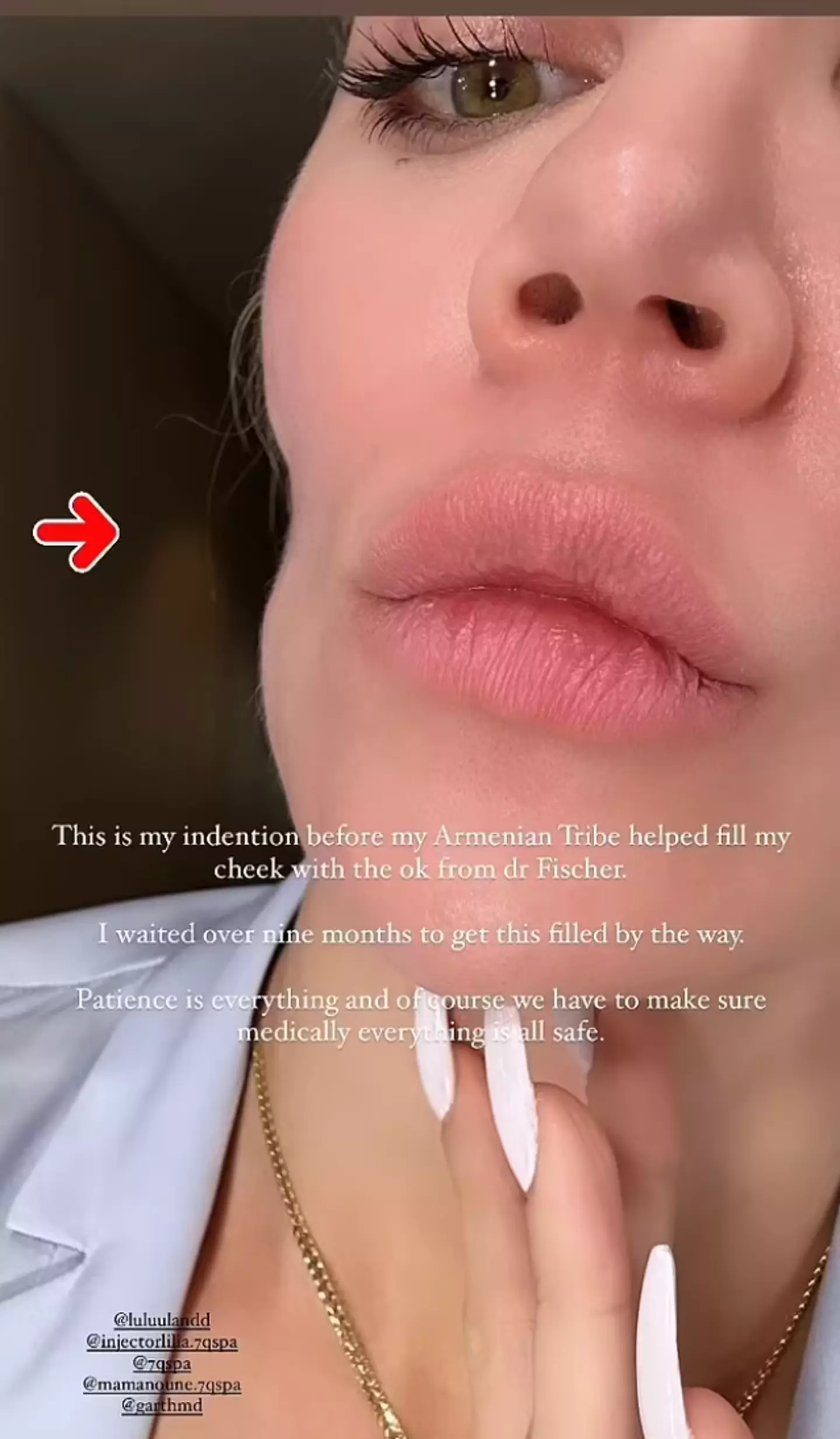 Kim's sister Khloe Kardashian has previously been diagnosed with melanoma twice.