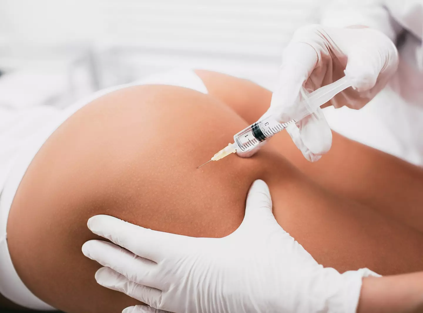 The BBL surgery has the 'highest death rate of all cosmetic procedures'. (peakSTOCK/Getty Images)