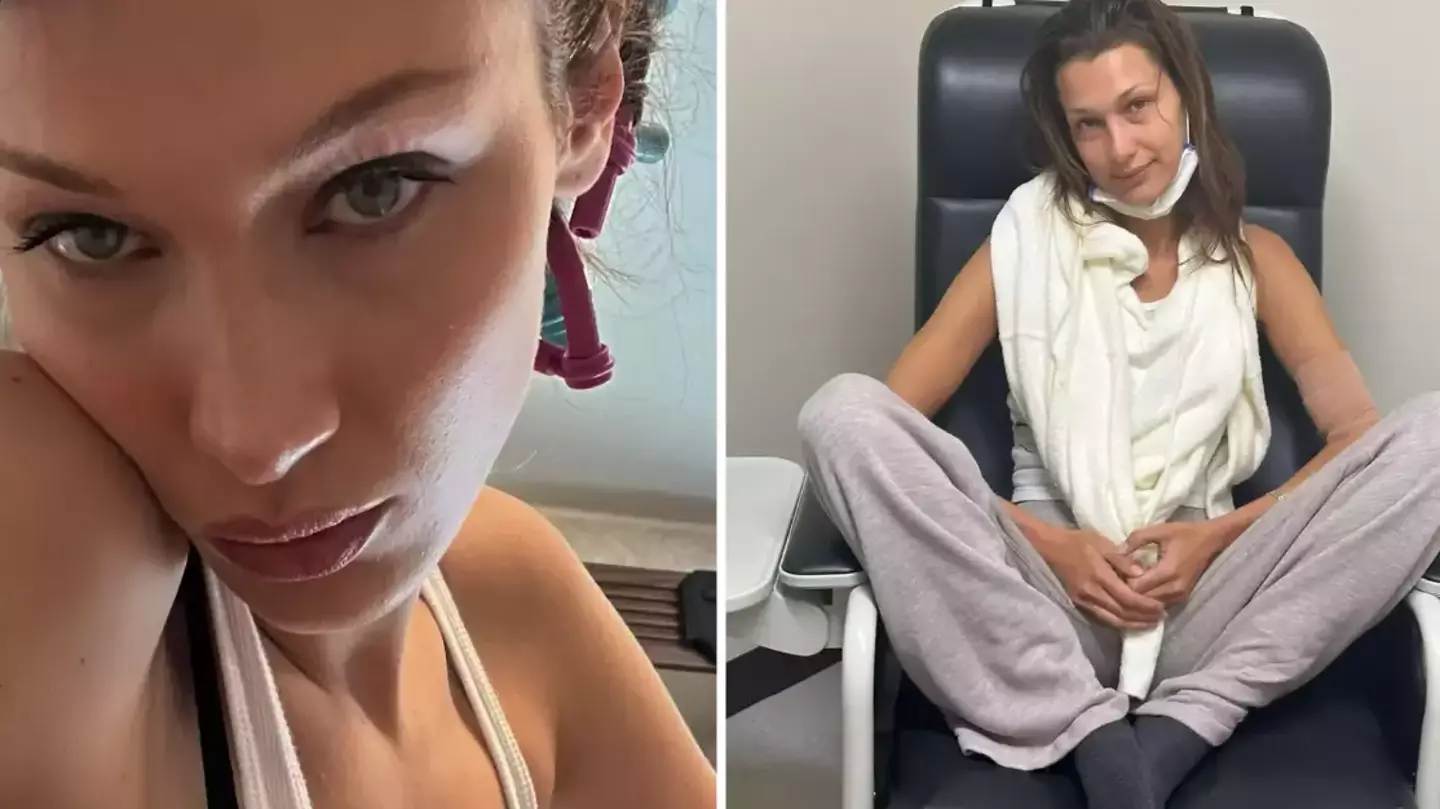 Bella Hadid opened up on little-known symptoms of disease common among other celebs