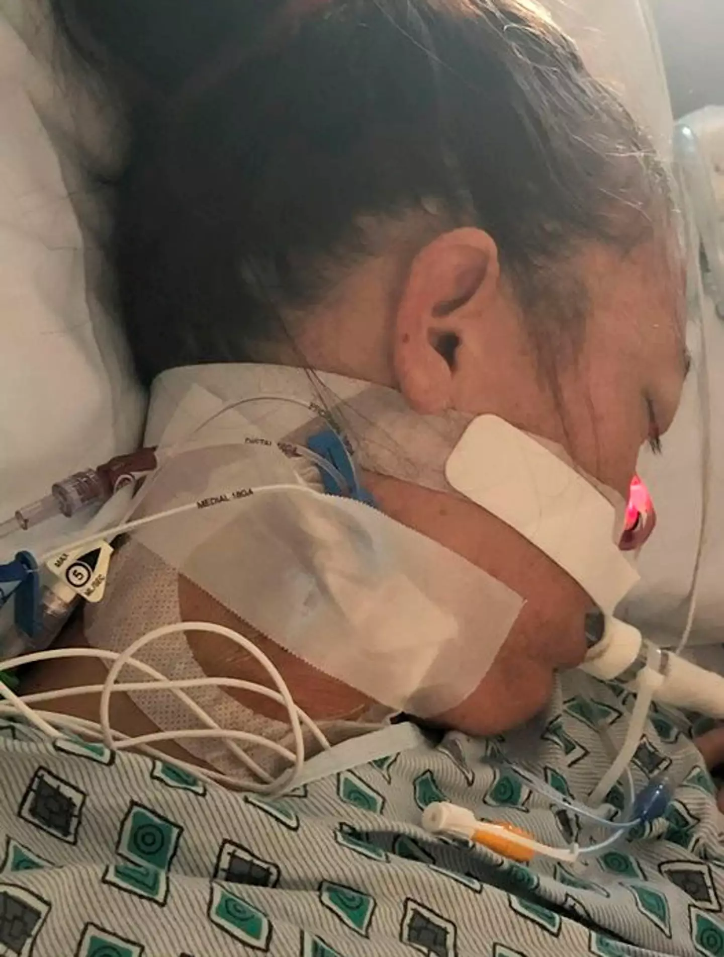 Amanda Stelzer was on life support for eight days.