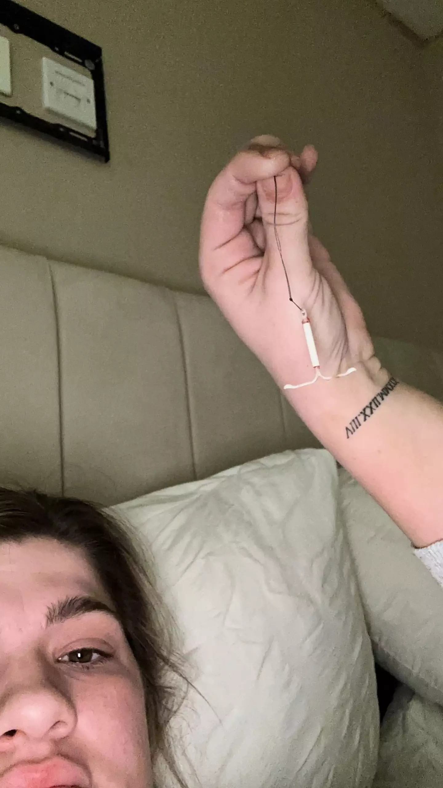 Kierra says she's 'not glorifying' DIY coil removals but that she was left with 'no choice' due to the long waiting time. (Kennedy)