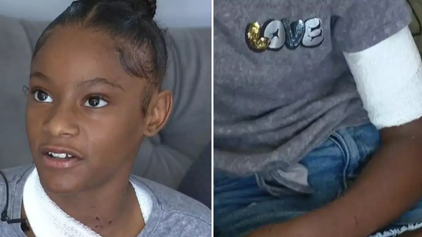 Girl, 12, charged with throwing acid on girl at playground leaving her with severe burns