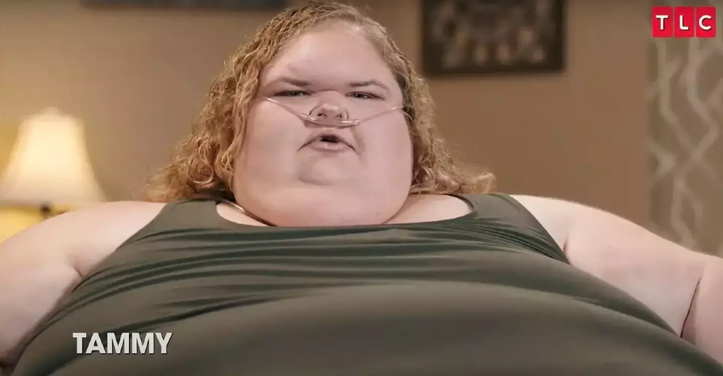 Tammy before her weight loss (TLC)