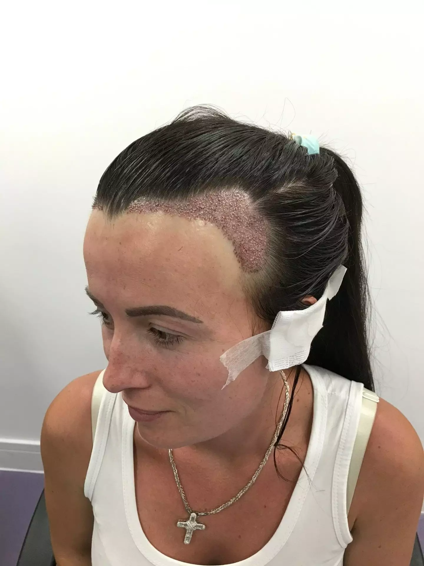 She said it was totally painless.